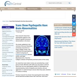 Scans Show Psychopaths Have Brain Abnormalities
