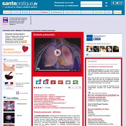 Embolie pulmonaire - Définition, Causes, Symptômes