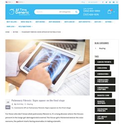 Pulmonary Fibrosis: Signs appear on the final stage