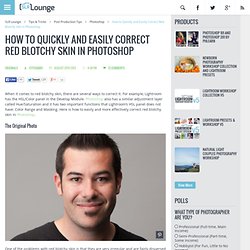 How to Quickly and Easily Correct Red Blotchy Skin in Photoshop