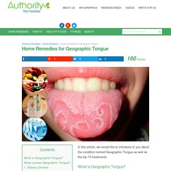 Home Remedies for Geographic Tongue - Authority Remedies