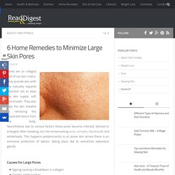 6 Home Remedies to Shrink Large Open Skin Pores