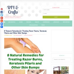 8 DIY Remedies For Treating Razor Burns, Keratosis Pilaris & Other Skin Bumps