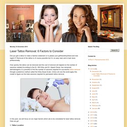 Laser Tattoo Removal: 6 Factors to Consider