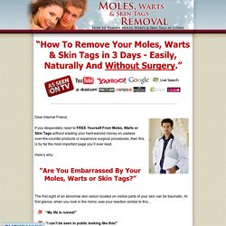 Moles, Warts & Skin Tags Removal - How To Safely & Permanently Remove Moles, Warts & Skin Tags