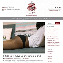 6 tips to remove your stretch marks – Harley Street Surgery