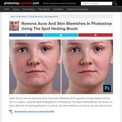 Removing Acne, Skin Blemishes With The Spot Healing Brush In Photoshop