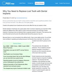 Why You Need to Replace Lost Tooth with Dental Implants