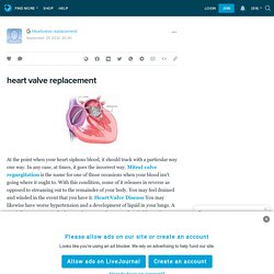 heart valve replacement