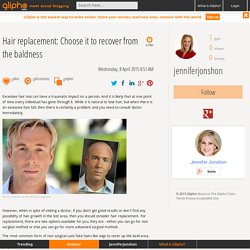 Hair replacement: Choose it to recover from the baldness