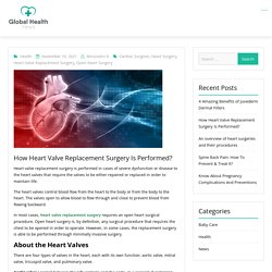 How Heart Valve Replacement Surgery Is Performed? - The Global Heallth News