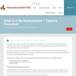 What is a Hip Replacement - Types & Procedure - Hip Replacement