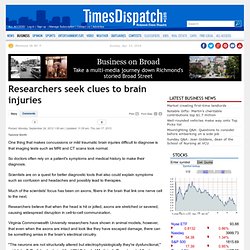 Researchers seek clues to brain injuries