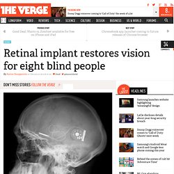 Retinal implant restores vision for eight blind people