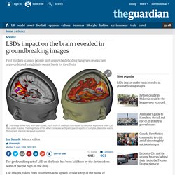 LSD's impact on the brain revealed in groundbreaking images