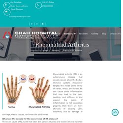 Rheumatoid Arthritis Shah Hospital - Laparoscopic Center