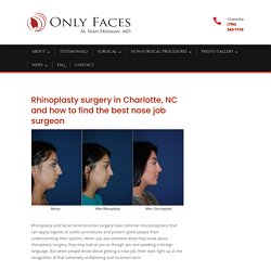Rhinoplasty expert in Charlotte, NC and finding the top nose job surgeon