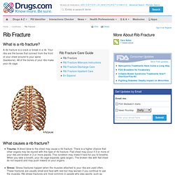 Rib Fracture - Care Guide