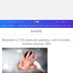 Sarampo: Brasil tem 2.753 casos da doença, com 4 mortes; número cresceu 18%