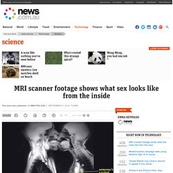 MRI scanner footage shows what sex looks like from the inside