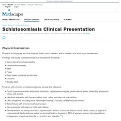 Schistosomiasis Clinical Presentation: History, Physical Examination