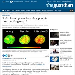 Radical new approach to schizophrenia treatment begins trial