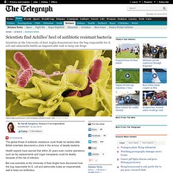 Scientists find Achilles' heel of antibiotic resistant bacteria