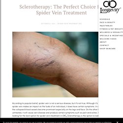 Sclerotherapy: The Perfect Choice for Spider Vein Treatment