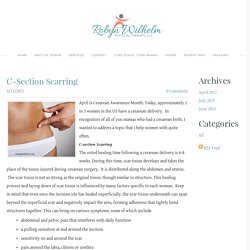 C-Section Scarring - Robyn Wilhelm, PT, DPT   Physical Therapy