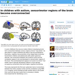 In children with autism, sensorimotor regions of the brain become overconnected