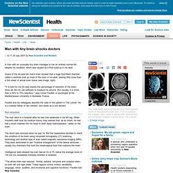 Man with tiny brain shocks doctors - health - 20 July 2007