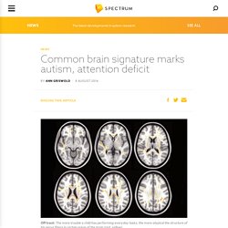 Autism, OCD and Attention Deficit May Share Brain Markers