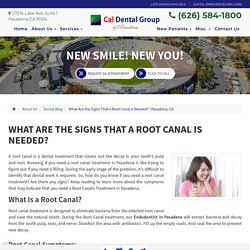 What Are The Signs That a Root Canal is Needed