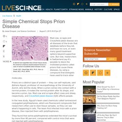 Simple Chemical Stops Prion Disease