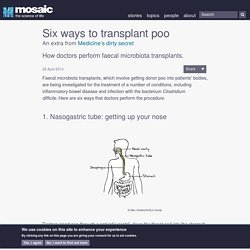 Six ways to transplant poo