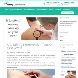 Skin Tag Removal Orange County - Is It Safe?