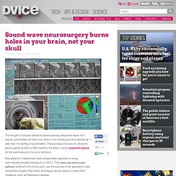 Sound wave neurosurgery