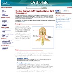 Cervical Spondylotic Myelopathy (Spinal Cord Compression) - Your Orthopaedic Connection