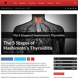 The 5 Stages of Hashimoto’s Thyroiditis - VIRAL FACTS