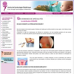 La stérilisation ESSURE - Traitement cancer gynecologique Marseille,Aubagne - Centre de Gynécologie Obstétrique