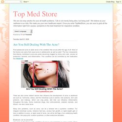 Top Med Store: Are You Still Dealing With The Acne?