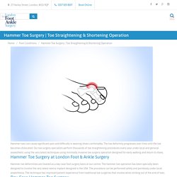 Toe Straightening and Shortening Surgery
