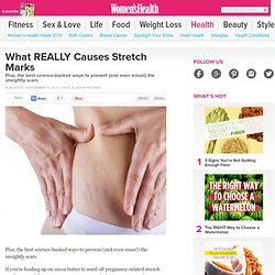 Stretch Marks: What Really Causes Them