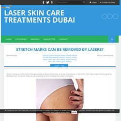 Stretch Marks Can Be Removed By Lasers? - Laser Skin Care Treatments Dubai