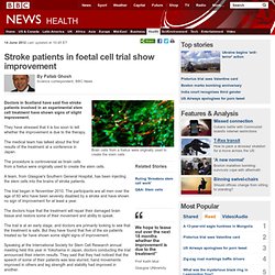 Stroke patients in foetal cell trial show improvement