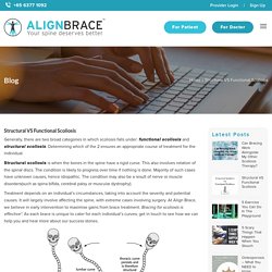 Structural VS Functional Scoliosis – Align Brace