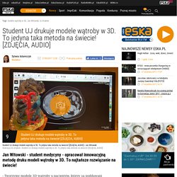 Student UJ drukuje modele wątroby w 3D. To jedyna taka metoda na świecie! [ZDJĘCIA, AUDIO] - Wiadomości - Kraków