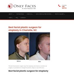 Best facial plastic surgeon for a successful otoplasty result in Charlotte, NC