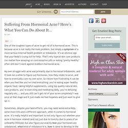 Suffering From Hormonal Acne? Here’s What You Can Do About It…