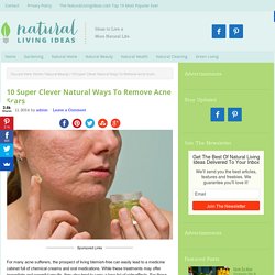 10 Super Clever Natural Ways To Remove Acne Scars